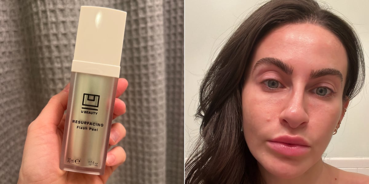 This At-Home Chemical Peel Works Wonders on My Dark Spots