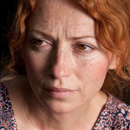 Experts Discuss Rosacea