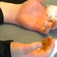 Warning: This Popular Slime Recipe Could Give Your Kid Third-Degree Burns