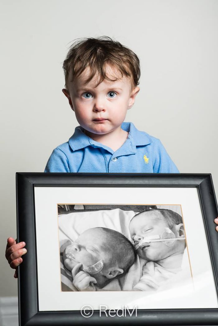 32 weeks premature twins