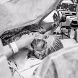 Took Months Over Having C-Section