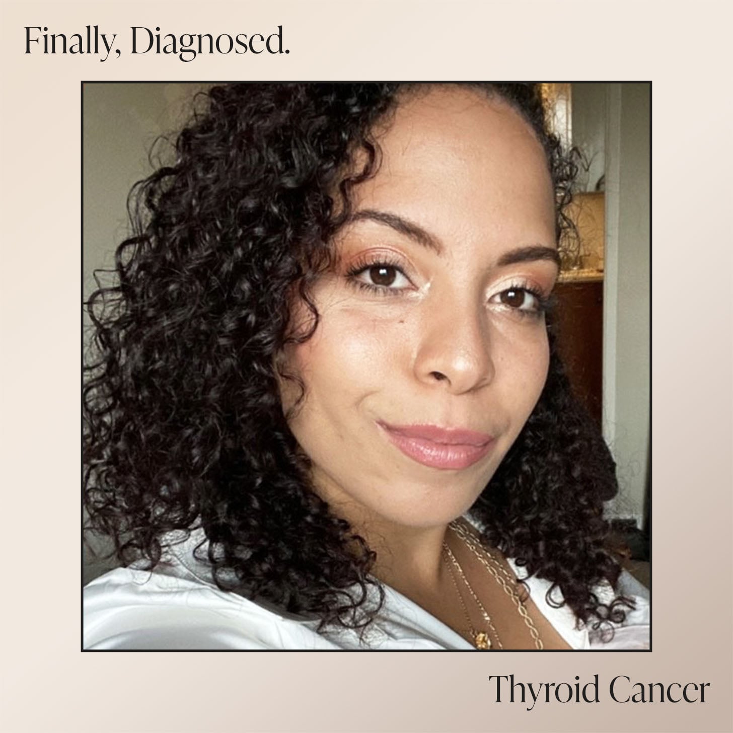 I Dealt With Extreme Fatigue and Hair Loss For 3-Plus Years Before Learning...
