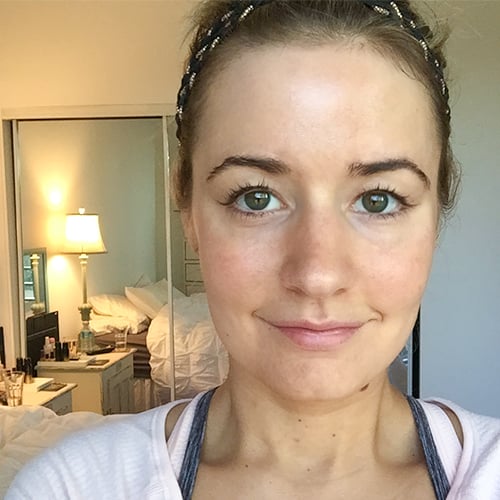 Dairy Effect on Skin