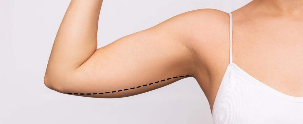 Brachioplasty: Cost, Recovery, Before and Afters of Arm Lift