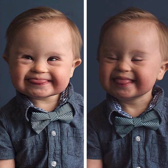 Boy With Down Syndrome Turned Down at Casting Call