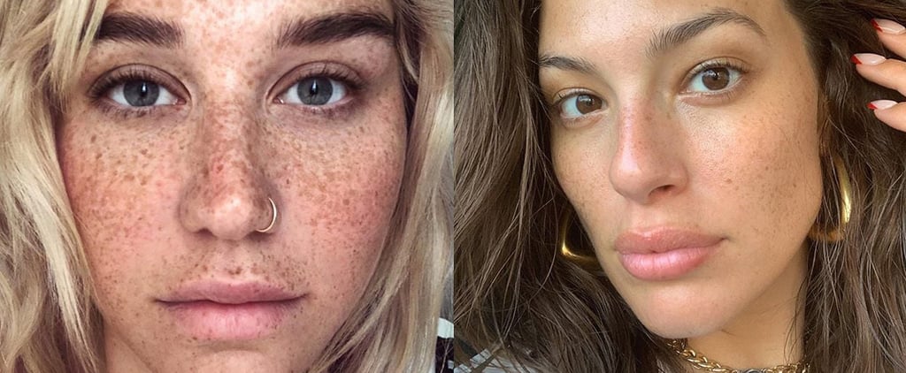 Celebrities With Freckles in No-Makeup Selfies