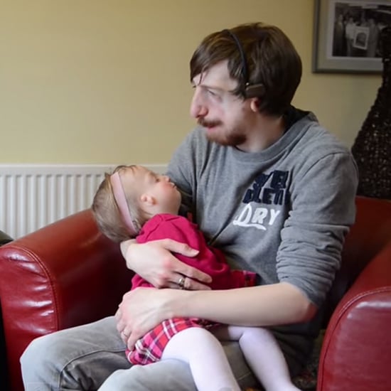 Family Has Baby With Treacher Collins Syndrome