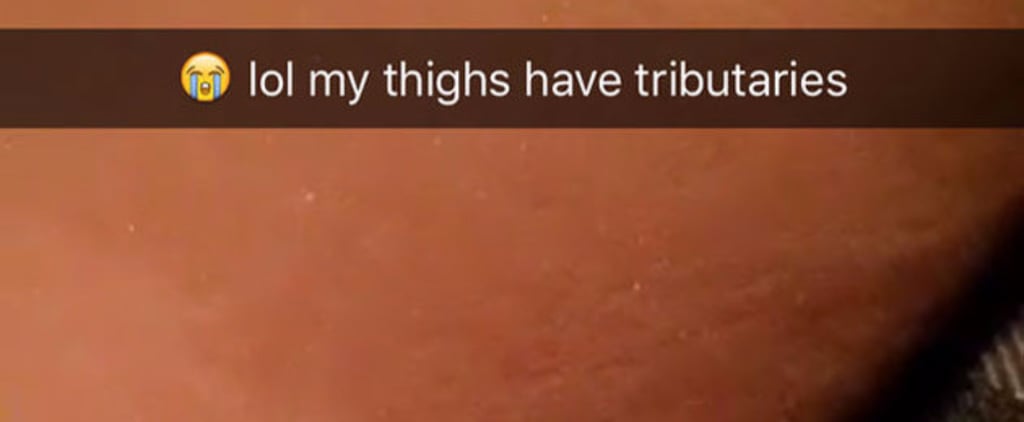 Chrissy Teigen Shares Stretch Marks on Snapchat