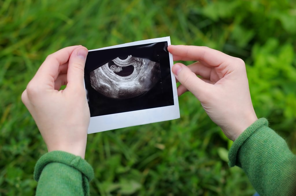 Some Fetus Cells Are Absorbed By the Mother — a Part of You Will Always Be With Your Mom Some Fetus Cells Are Absorbed By the Mother — a Part of You Will Always Be With Your Mom