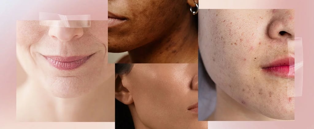 Skin Type Quiz: What Is Your Skin Type?