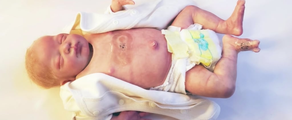 Wireless Technology For NICU Babies