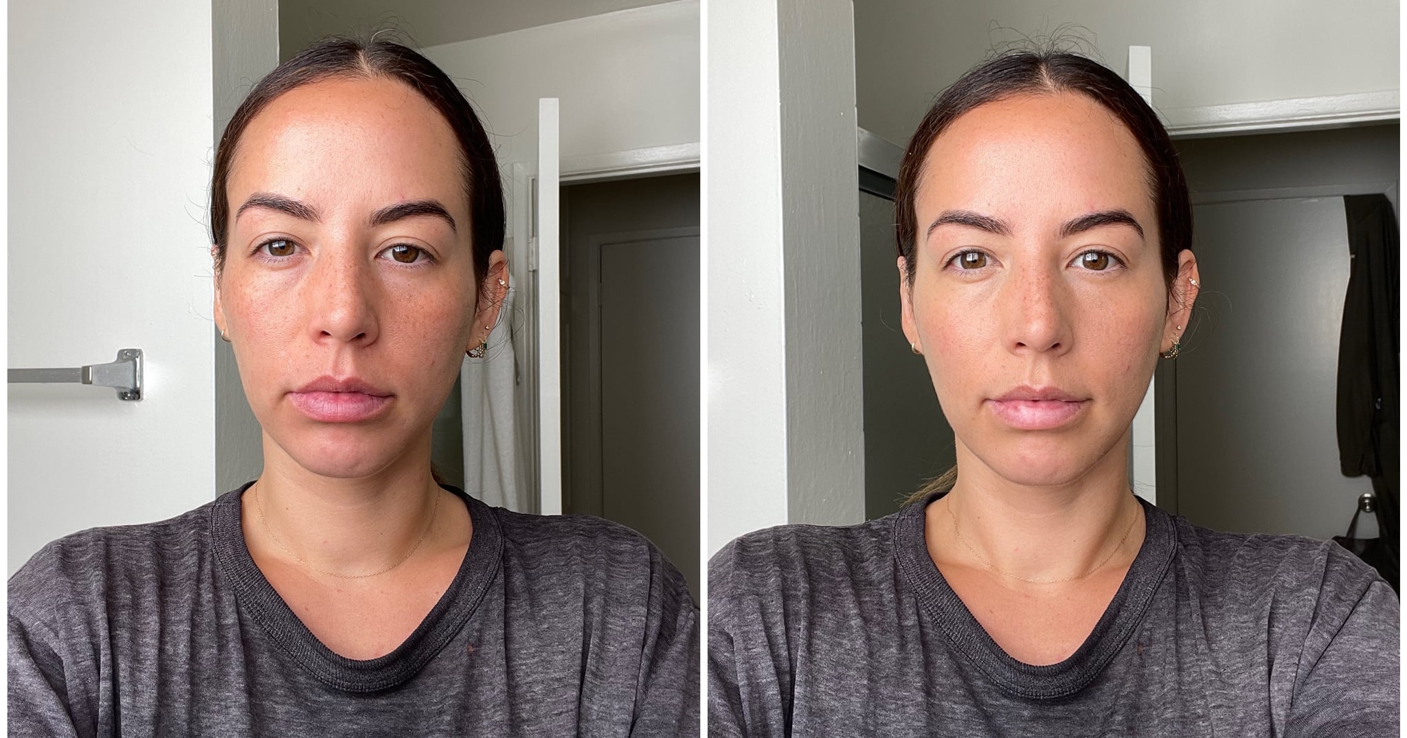This Viral 3-Dot Concealer Hack Gave Me a Makeshift Face-Lift