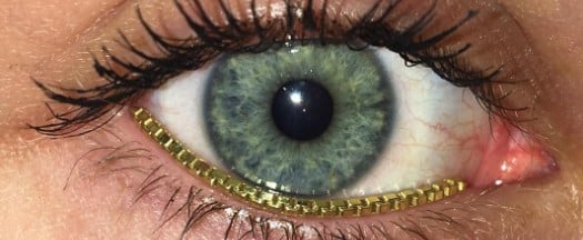What Is Bling Waterlining?