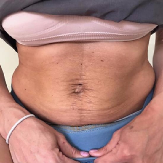Fitness Blogger's Postpartum Body