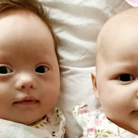 Rare Set of Twins Where Only One Baby Has Down Syndrome
