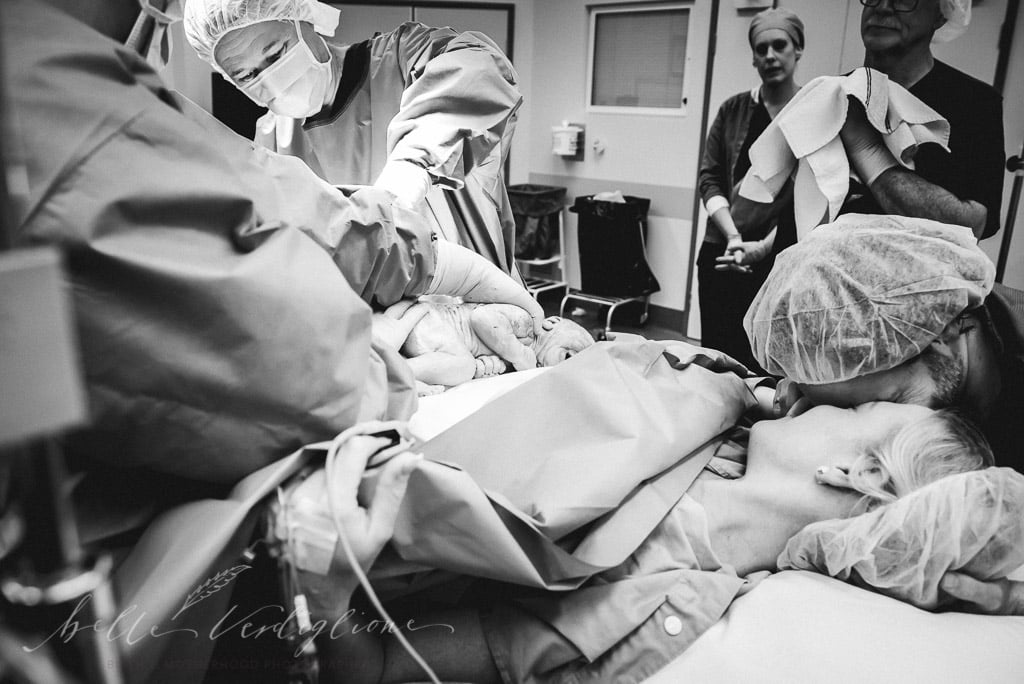 C-Section Mom Watching Baby's Birth