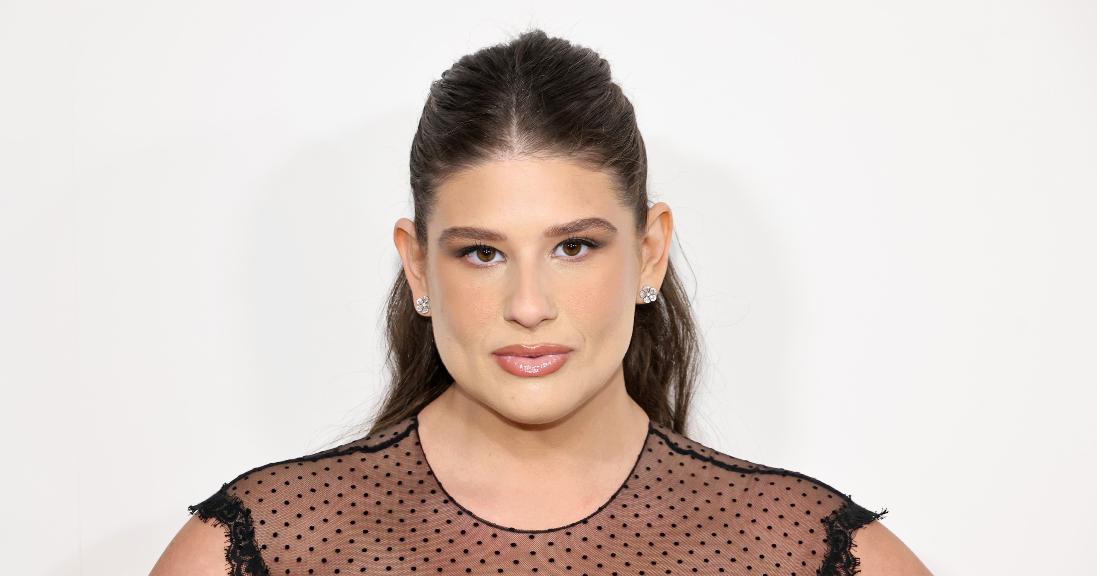 I Got Bariatric Surgery Like Remi Bader — Stop Shaming Us