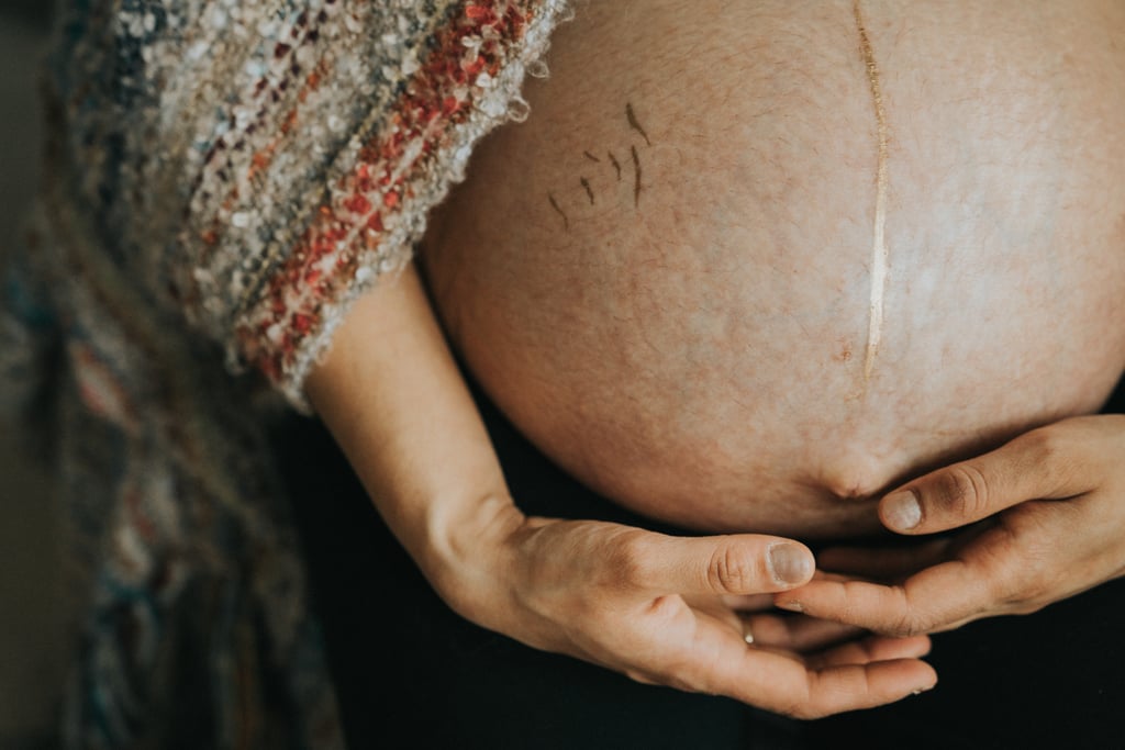 "Although you have always had the long stripe, due to changing hormones and increased melanin levels, it becomes quite prevalent during pregnancy! Some women find it to be quite unsightly, but this project is all about challenging those opinions."