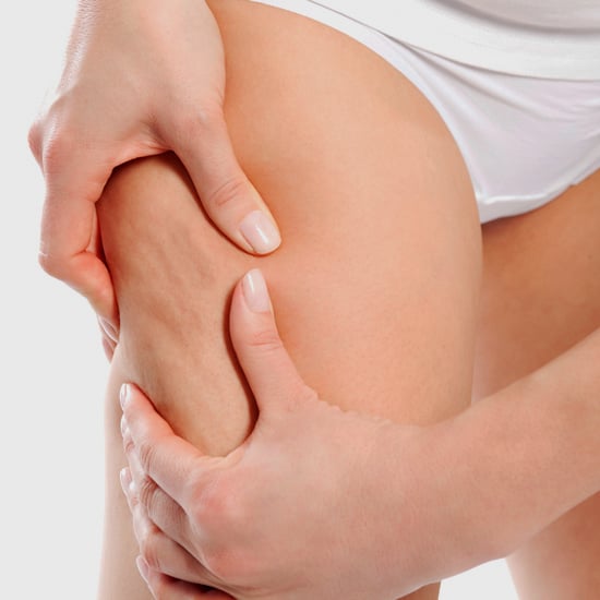 What Cellulite Treatments Work