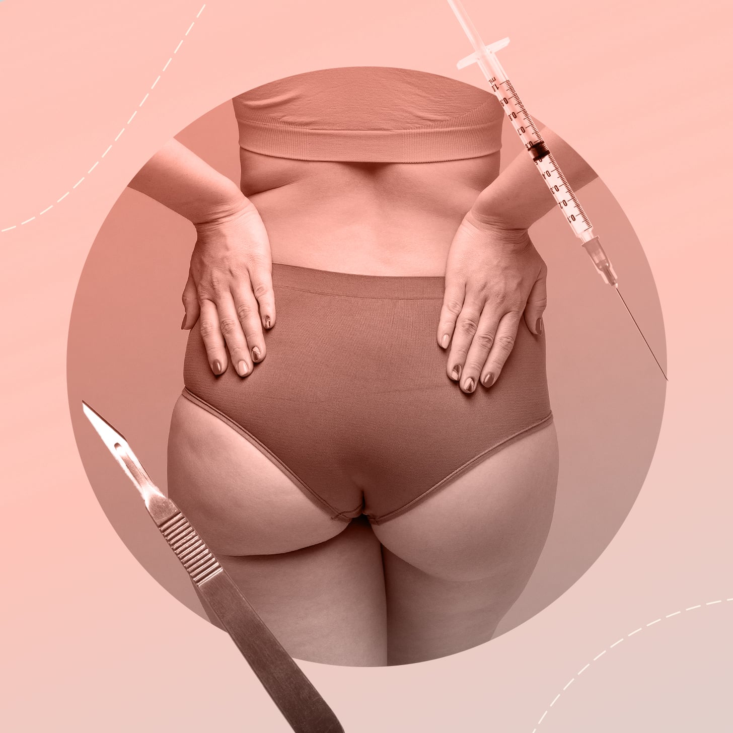 Risks of a Brazilian Butt Lift: What You Need to Know