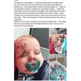 Every Parent Needs to See This Photo of What Happens When You Don't Vaccinate Your Kids