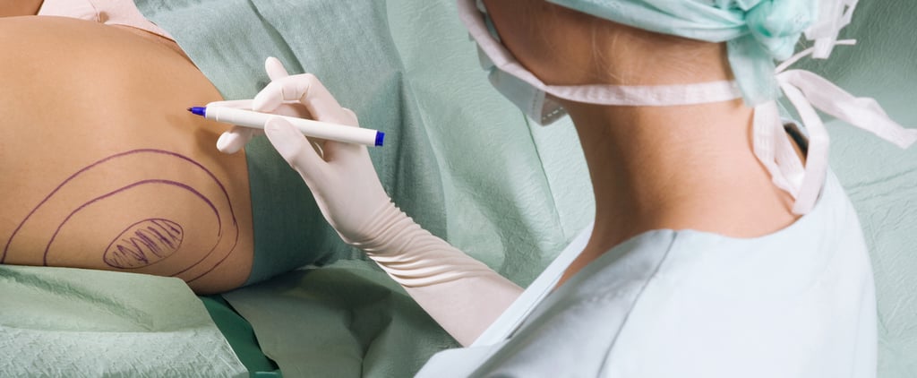 Liposuction Surgery: Cost, Risks, Recovery Time, and More