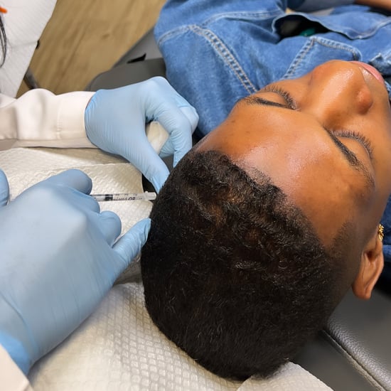 I Tried Botox For My Edges: See Photos