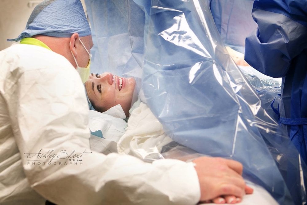 C-Section Birth Photography