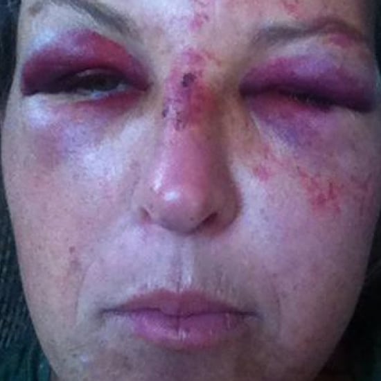 Montana Day Care Worker Assaulted by Drunk Father