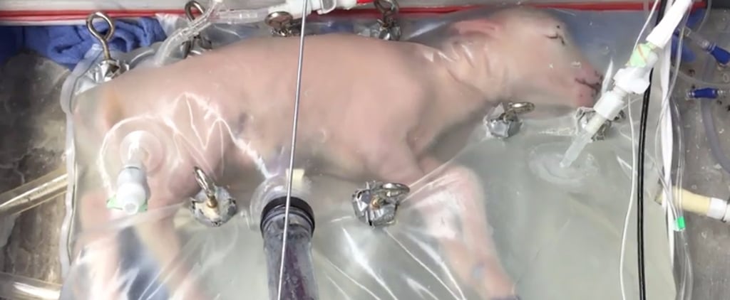 Artificial Womb Premature Babies