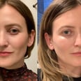 I Got Undereye Fillers, and the Results Are Game-Changing