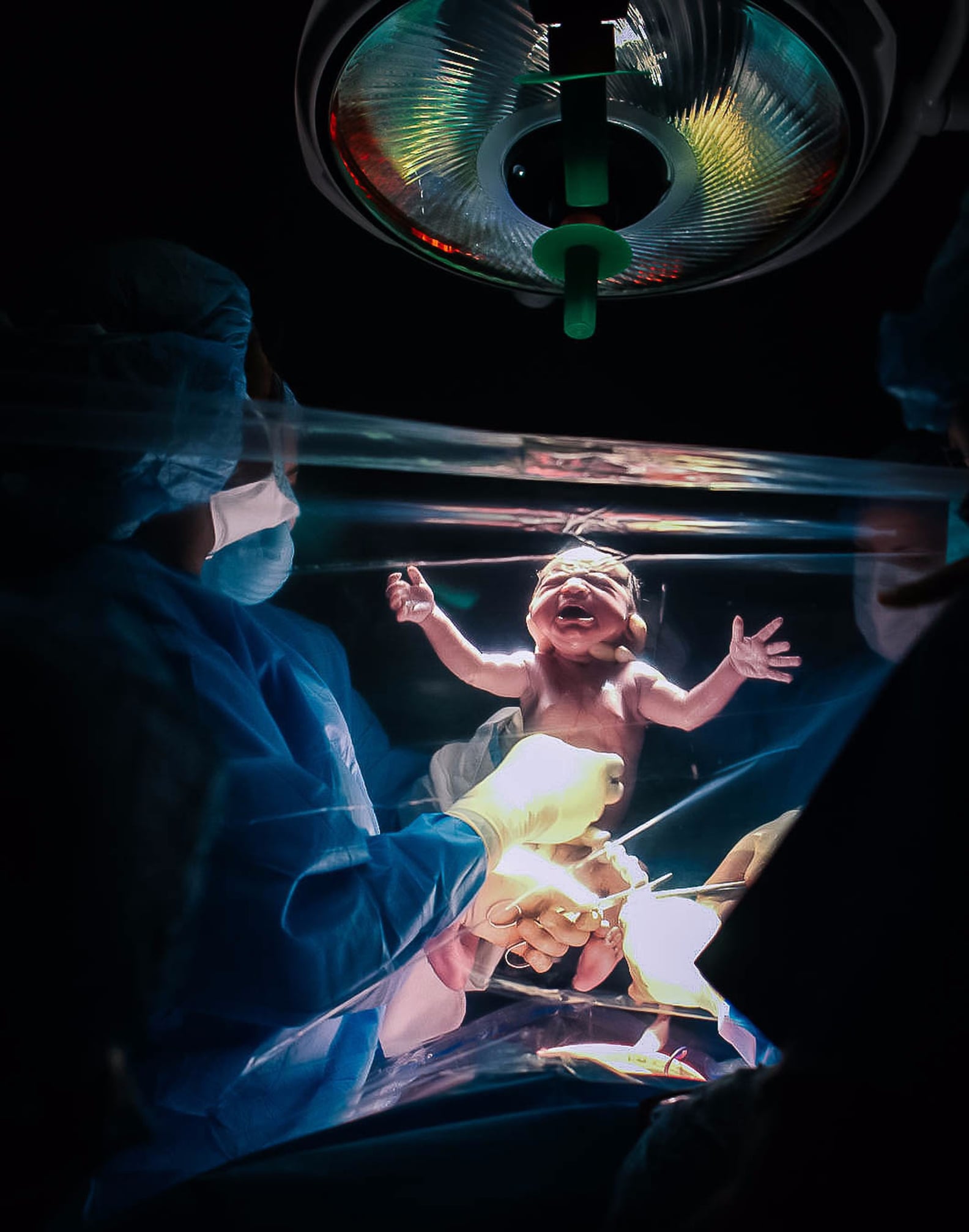 Exquisite C-section Or Natural Birth Image for Mobile