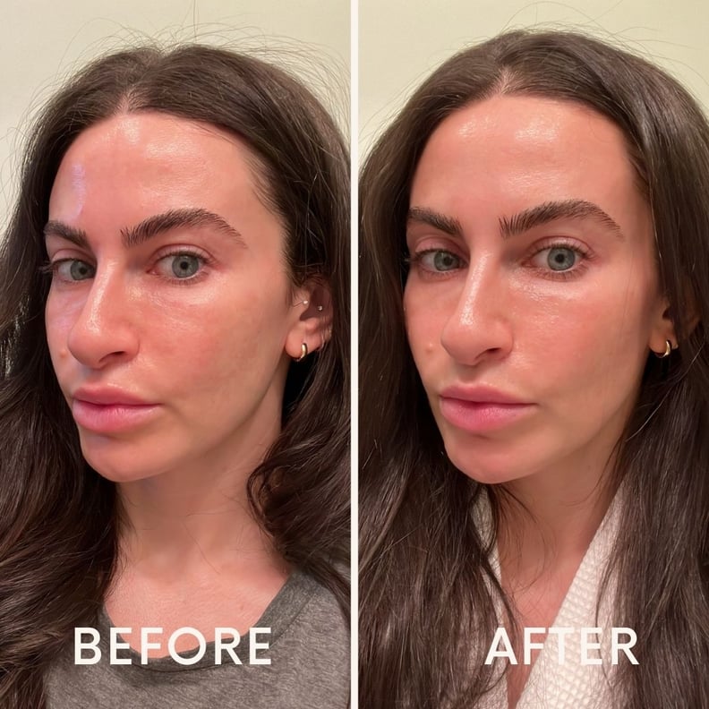 Mother Science Retinol Synergist before and after results