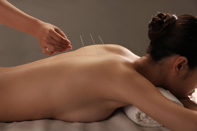 China: Acupuncture