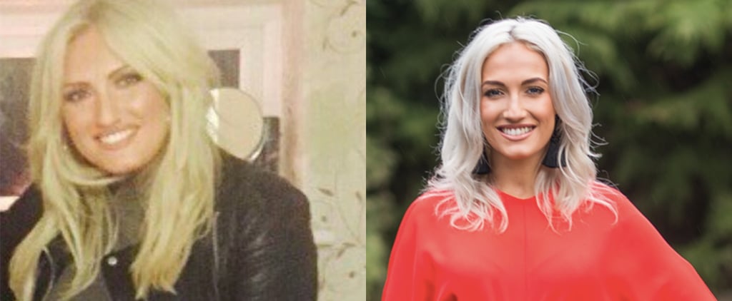 Before-and-After Weight-Loss Sophie Jude