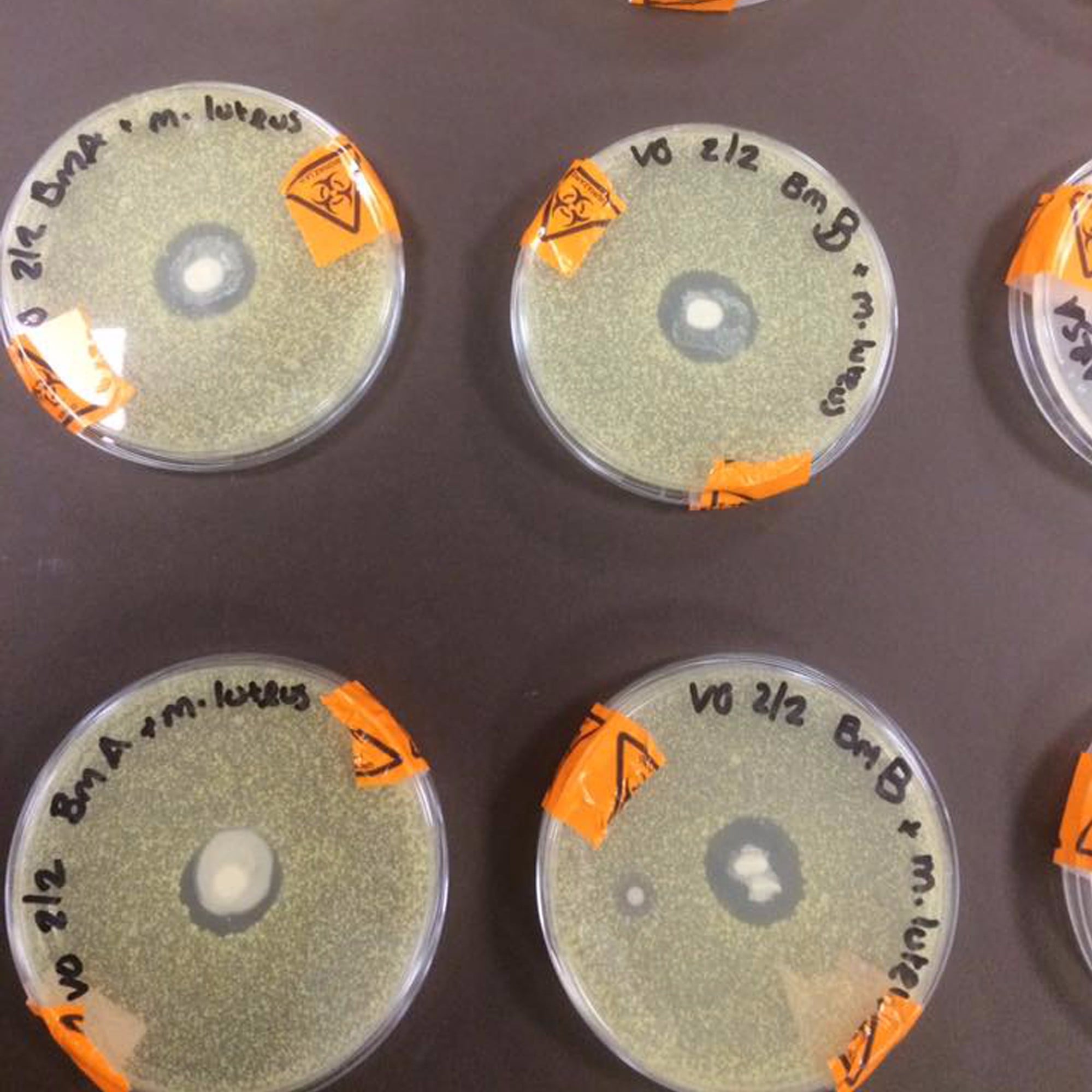 Science Experiment Showing Breast Milk Killing Bacteria Popsugar Family
