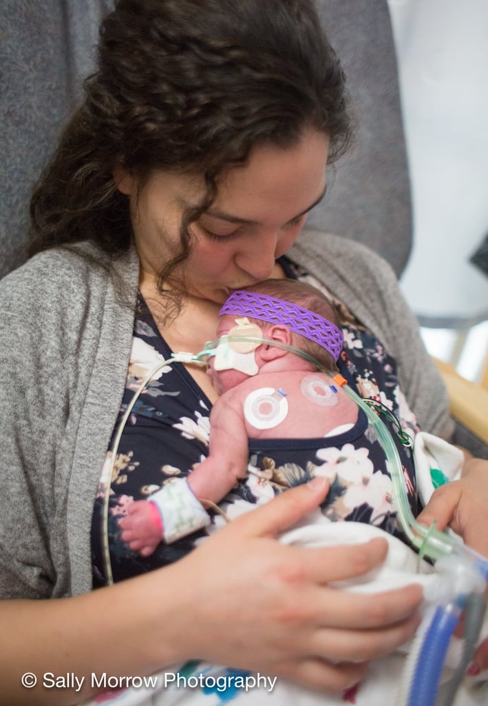 Moms Skin-to-Skin Bonding With Their Newborns in the NICU