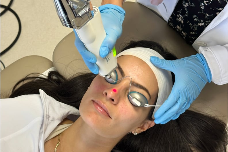 clearsilk laser before and after