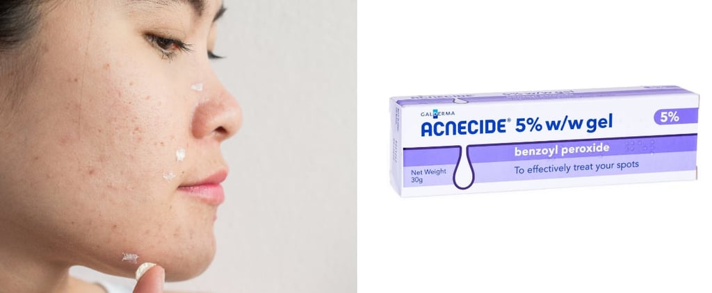 Benzoyl Peroxide Is Now Available Without Prescription in UK