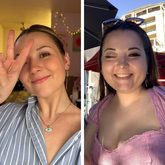 What It's Like Living With Cortisol Face