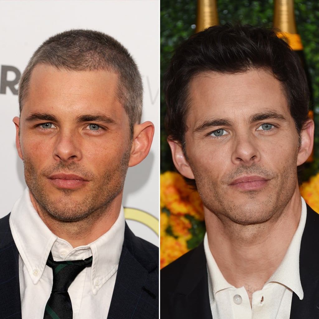 James Marsden  Male Celebrities With Hair vs. Shaved 