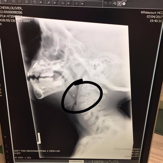 Why Metal Grill Brushes Are Dangerous