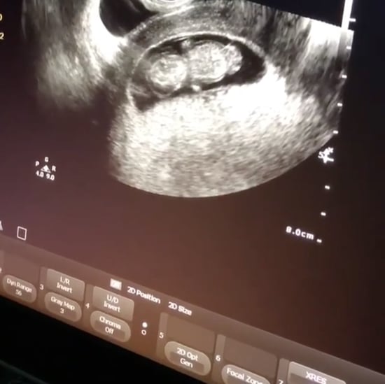 Joanna Gaines Ultrasound Video