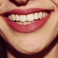 The Dangers of TikTok's Teeth-Filing Trend
