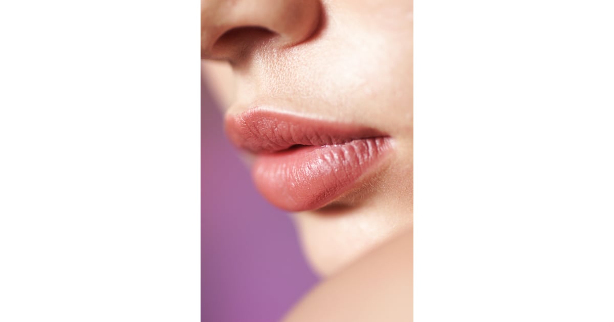 Electrolysis Pros Upper Lip Hair Removal POPSUGAR Beauty Photo 12