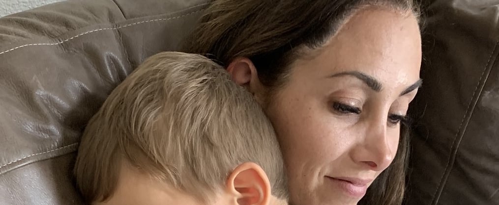 How the Pandemic Helped Me Accept My Scar | Personal Essay
