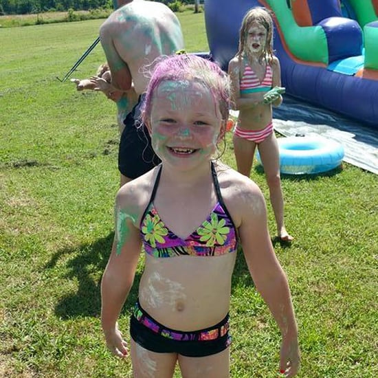 Girl Kicked Off Water Slide For Having a Prosthetic Leg