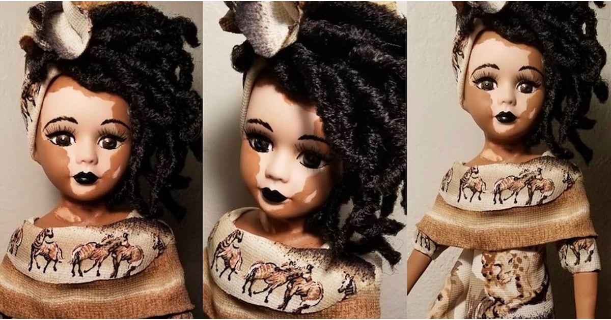 Dolls With Vitiligo POPSUGAR Beauty