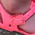 Why This Mom Is Warning Parents to Check Their Kids' Sandals This Summer