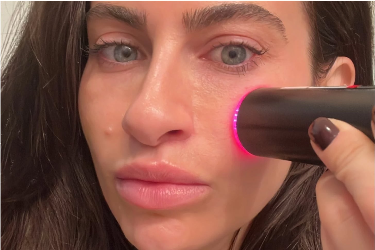 lyma laser review